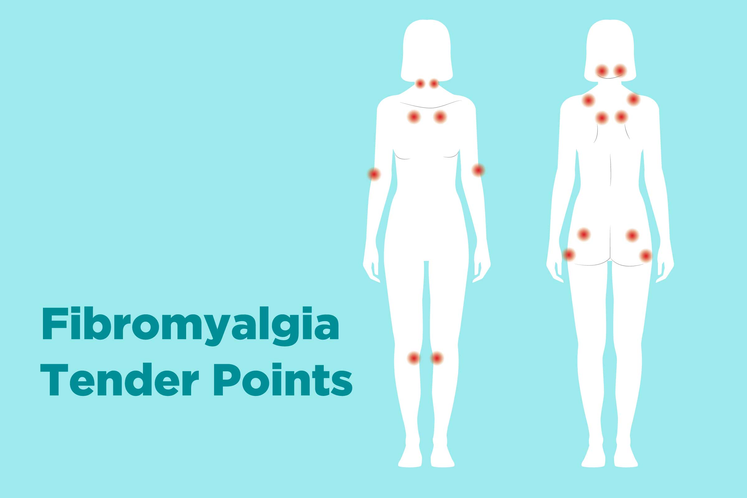 Fibromyalgia Symptoms in Women